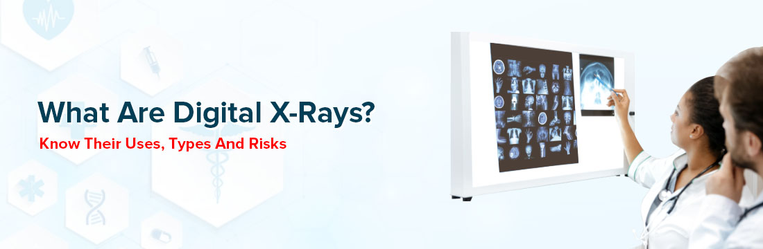 What Are Digital X-Rays? Know Their Uses, Types And Risks
